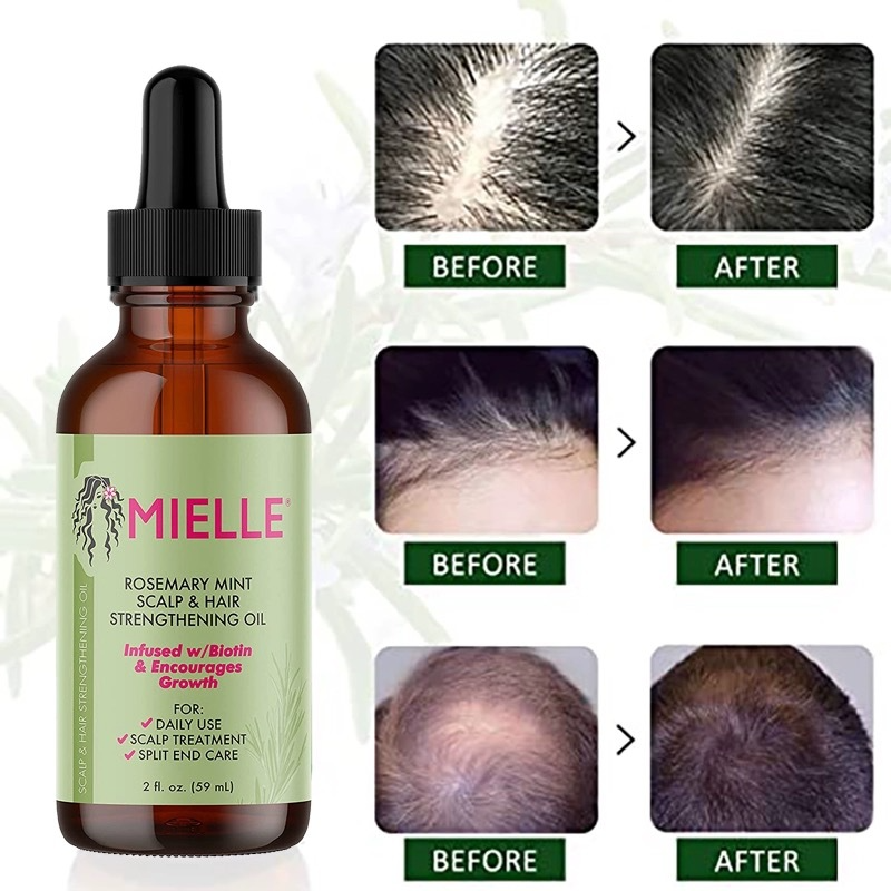 Hair Growth Organic Rosemary Mint Scalp & Hair Strengthening Oil